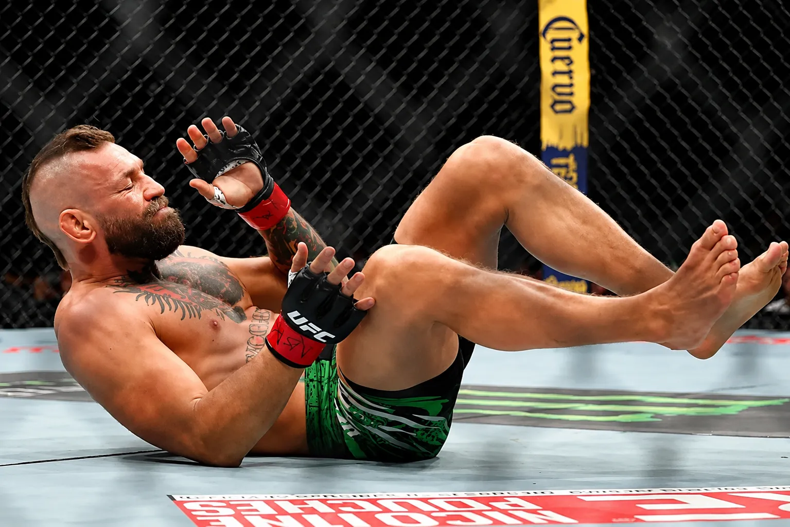 Conor McGregor Confirms Surgery After UFC 329 Injury But Vows to Fight Again